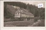 Hirschsprung