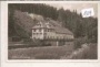 Hirschsprung